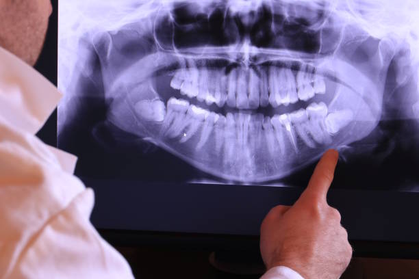 Best Emergency Treatment for Oral Infections in Amargosa Valley, NV