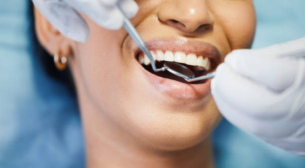Best Broken or Chipped Tooth Repair in Amargosa Valley, NV